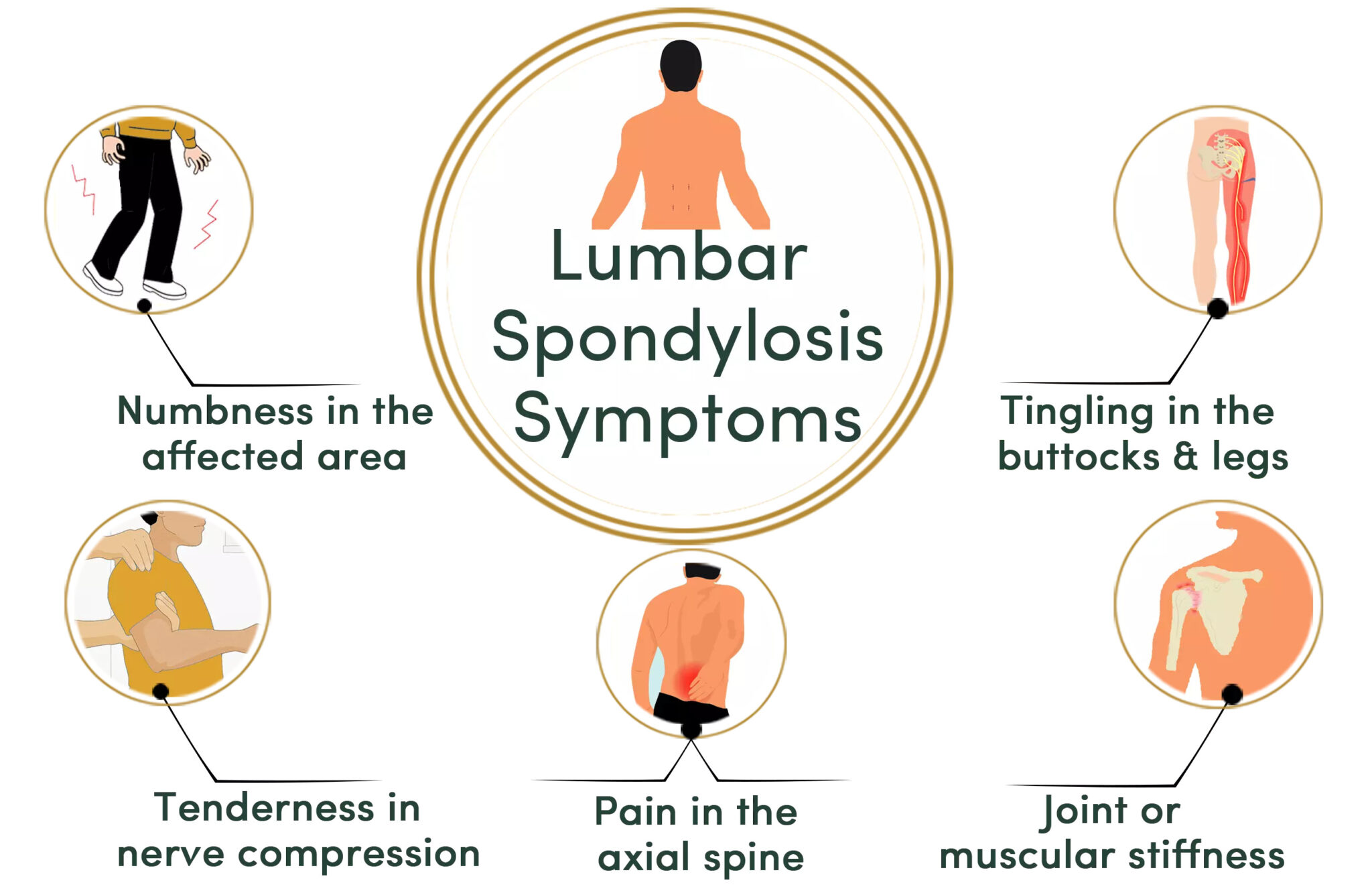 Lumbar Spondylosis Ayurvedic Treatment - Durja Ayurveda