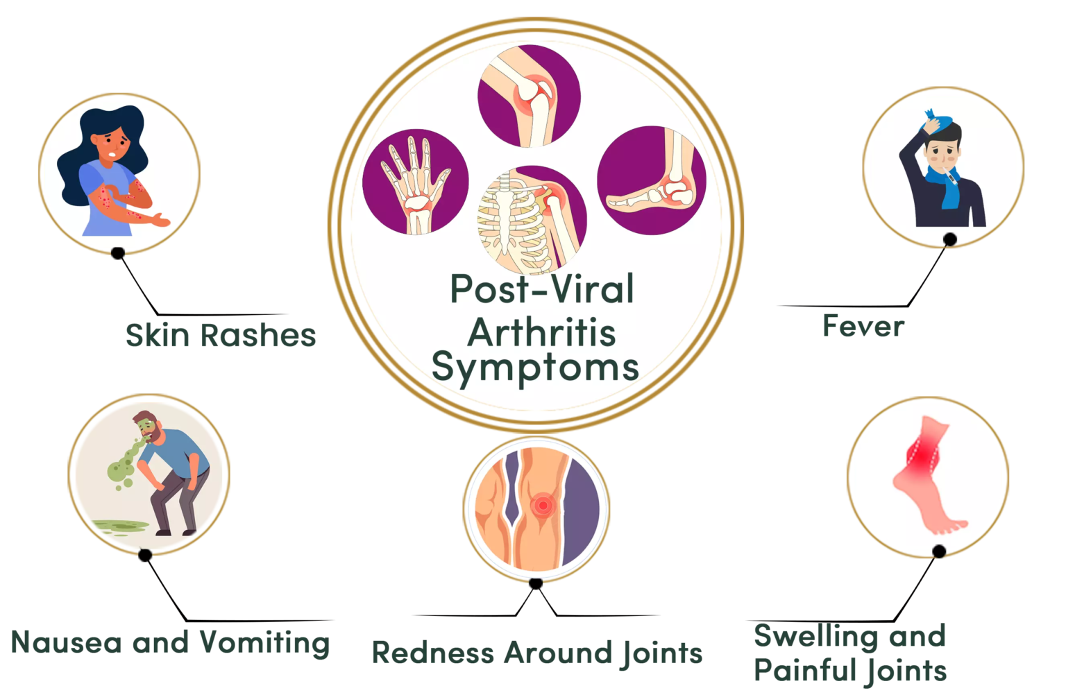 Post Viral Arthritis Treatment - Durja Ayurveda