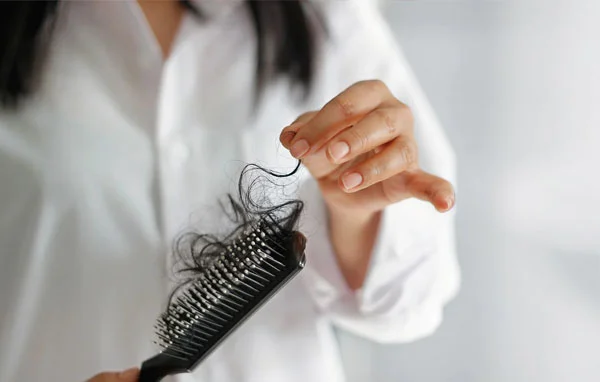 Consult Hairfall