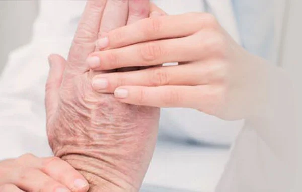 Consult Rheumatic