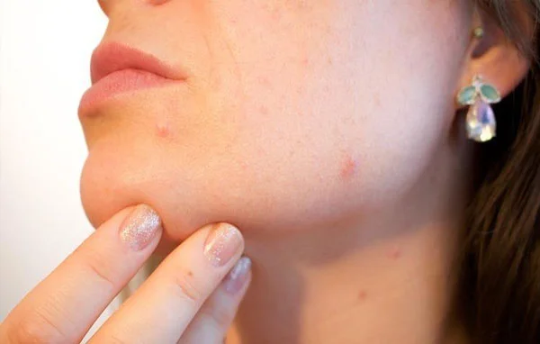 Consult Skin